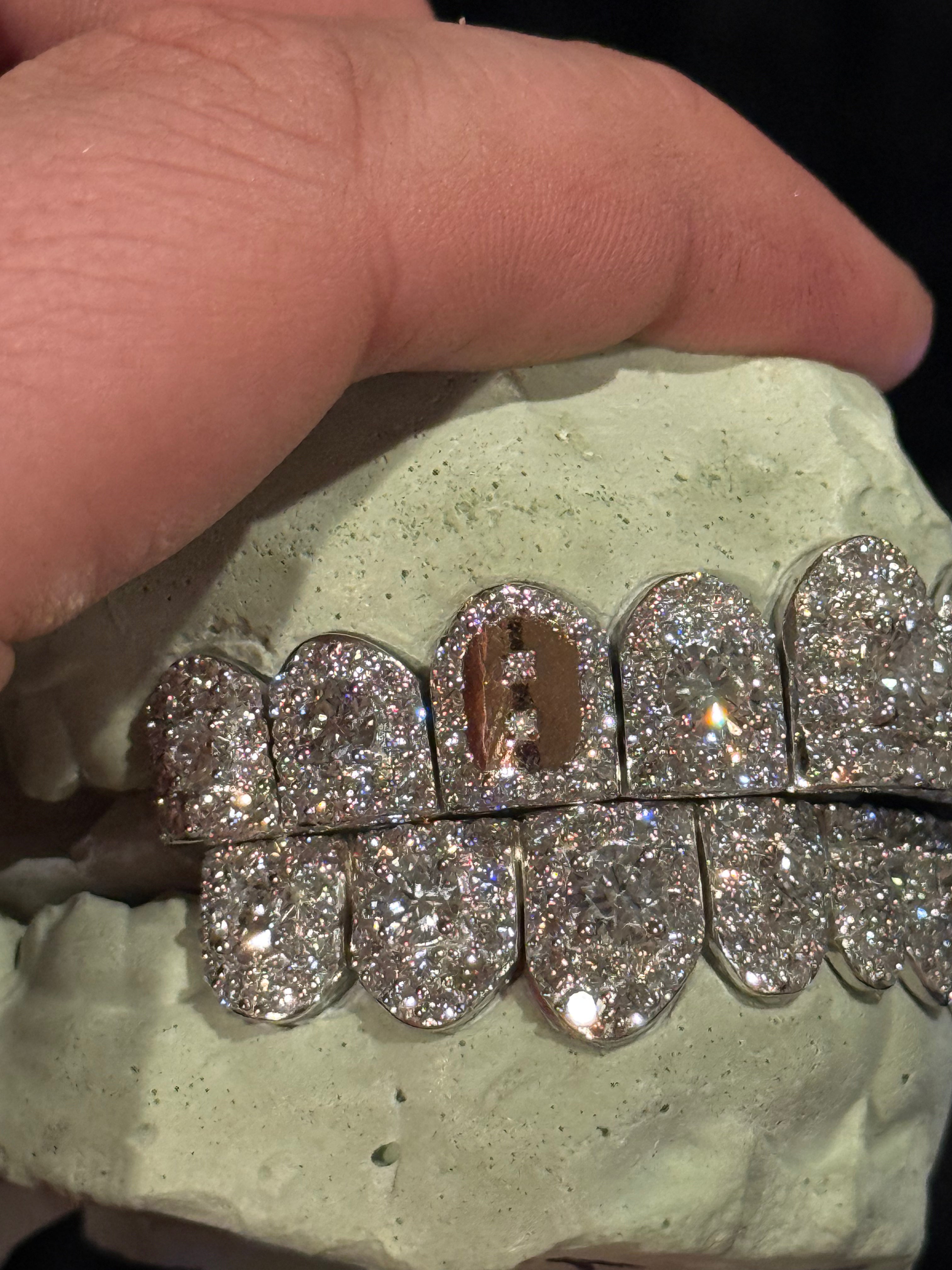 SILVER AND LAB GROWN DIAMOND HONEYMOON GRILL (BALL PLAYER)