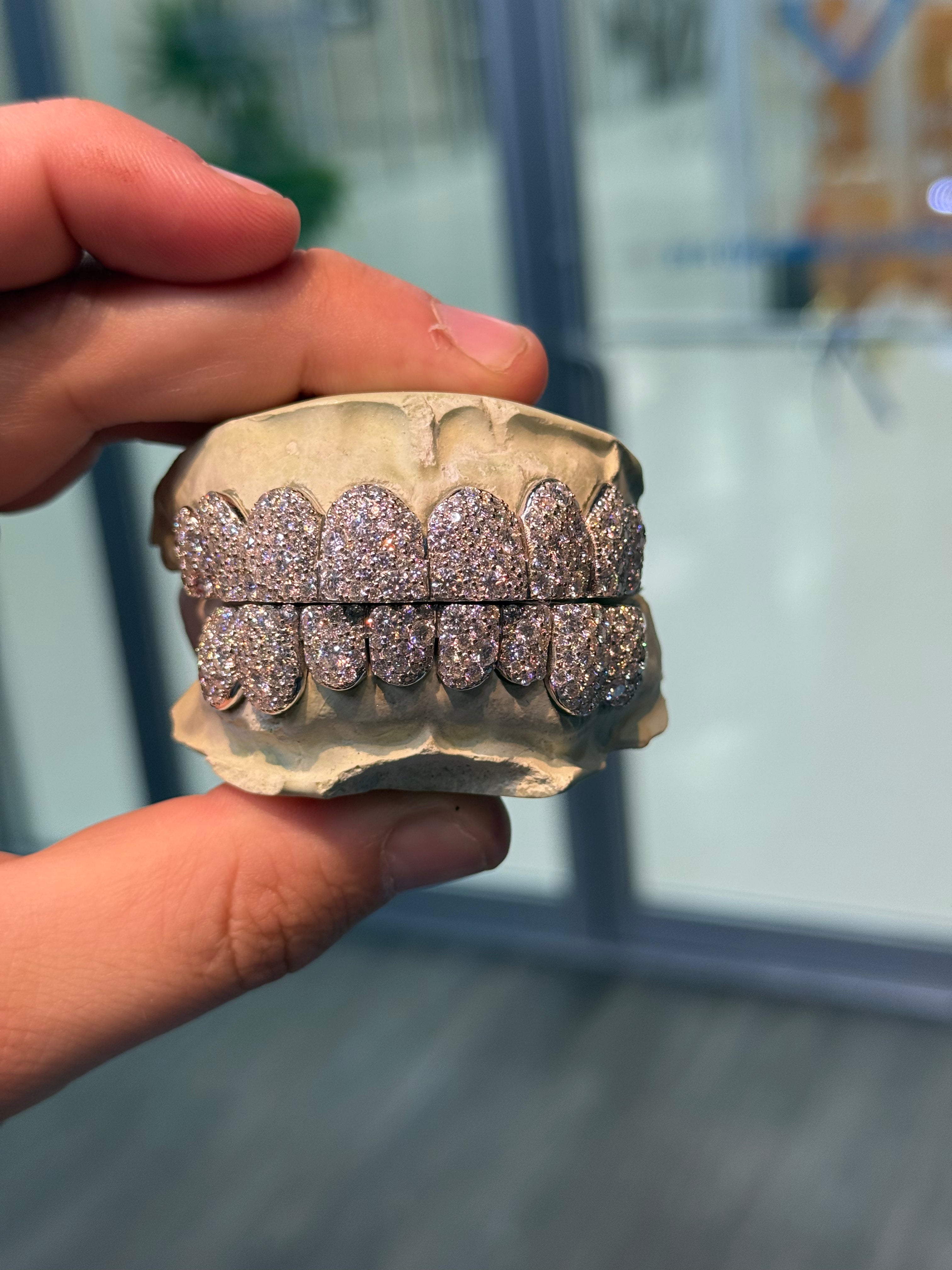 GALAXY SET CVD LAB GROWN DIAMOND GRILLZ