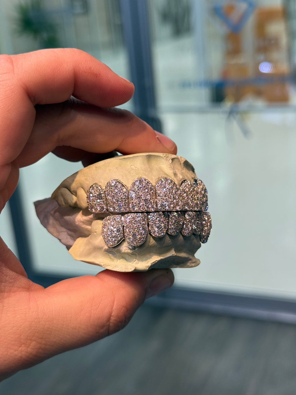 GALAXY SET CVD LAB GROWN DIAMOND GRILLZ