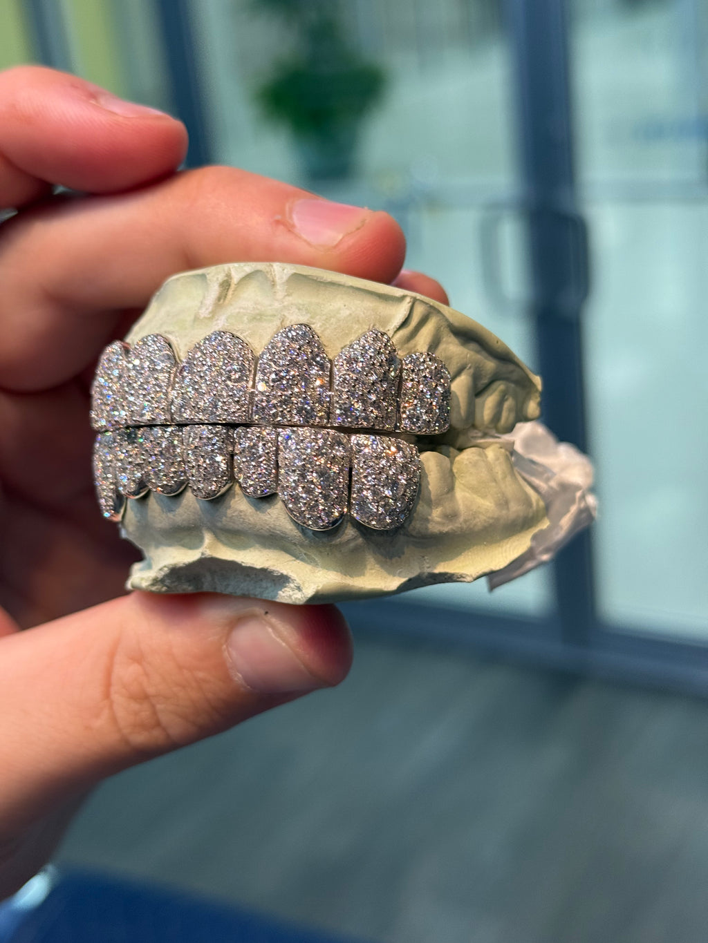 GALAXY SET CVD LAB GROWN DIAMOND GRILLZ