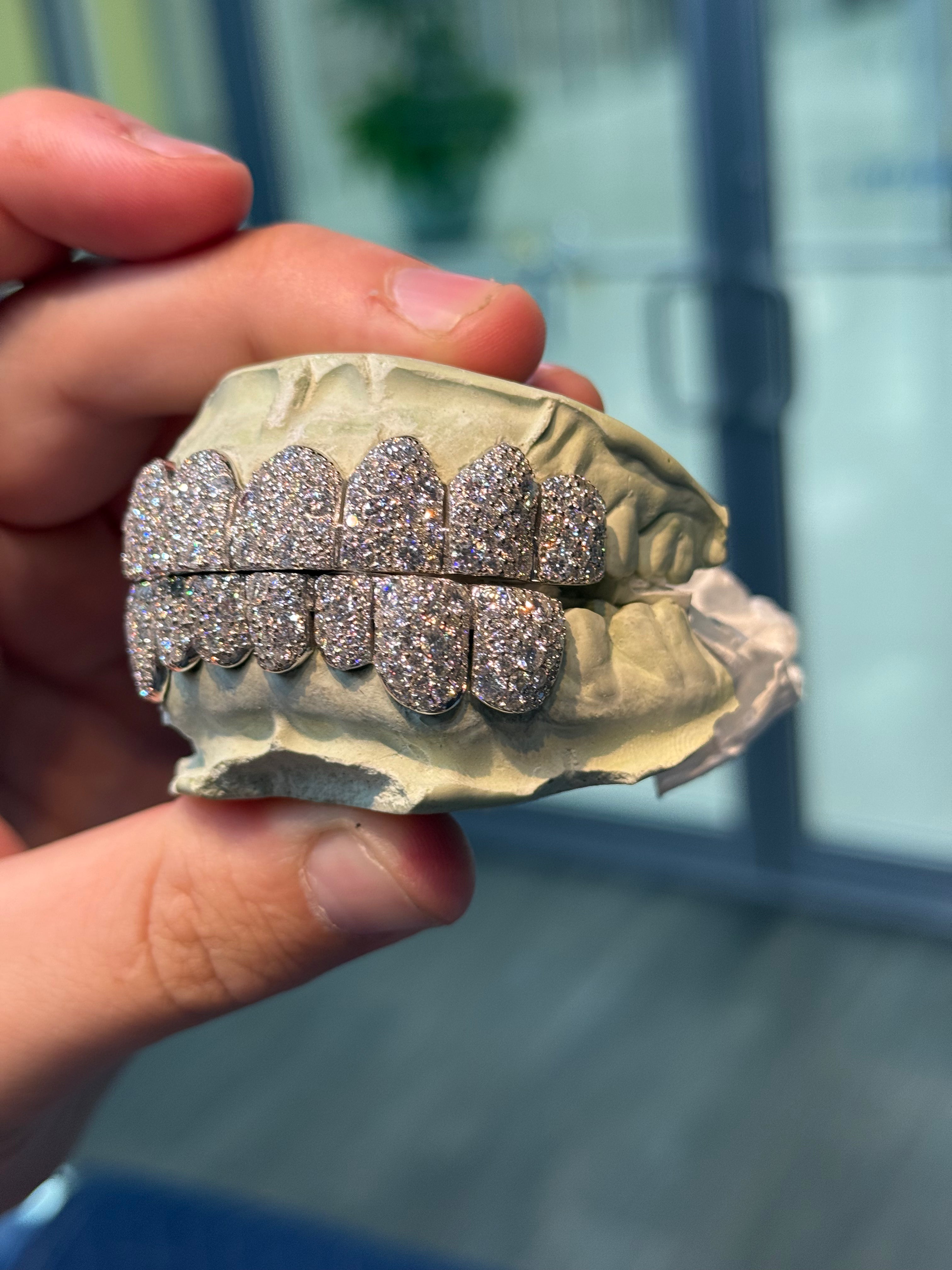 GALAXY SET CVD LAB GROWN DIAMOND GRILLZ