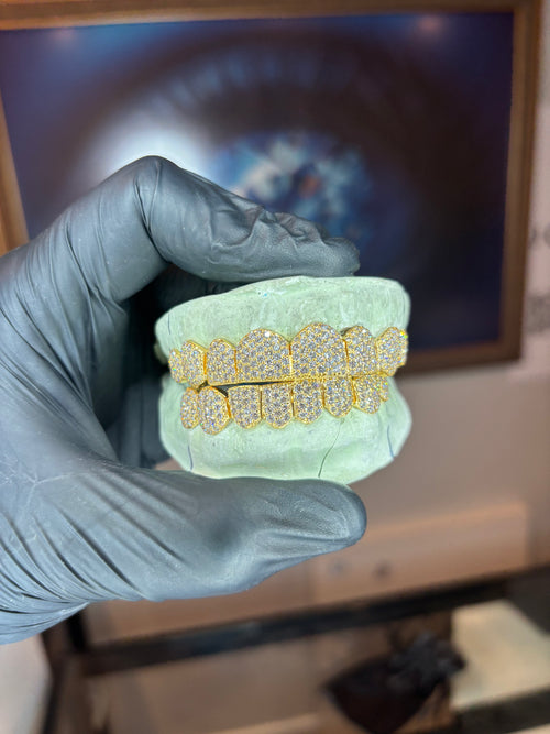 10K GOLD LAB GROWN DIAMOND GRILLZ