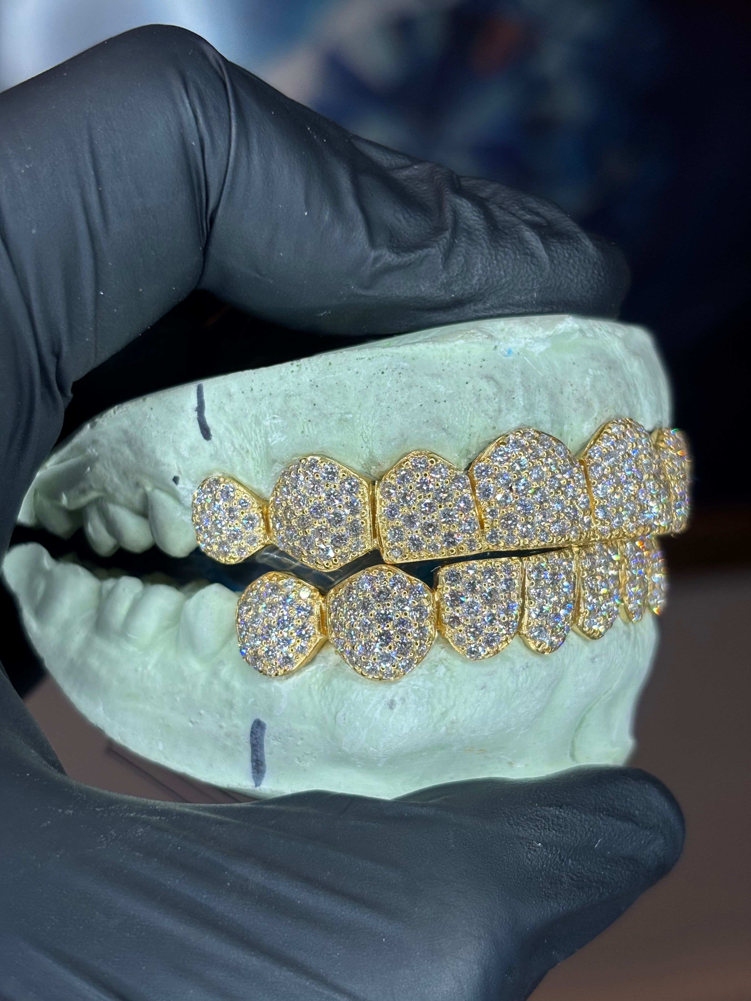 10K GOLD LAB GROWN DIAMOND GRILLZ