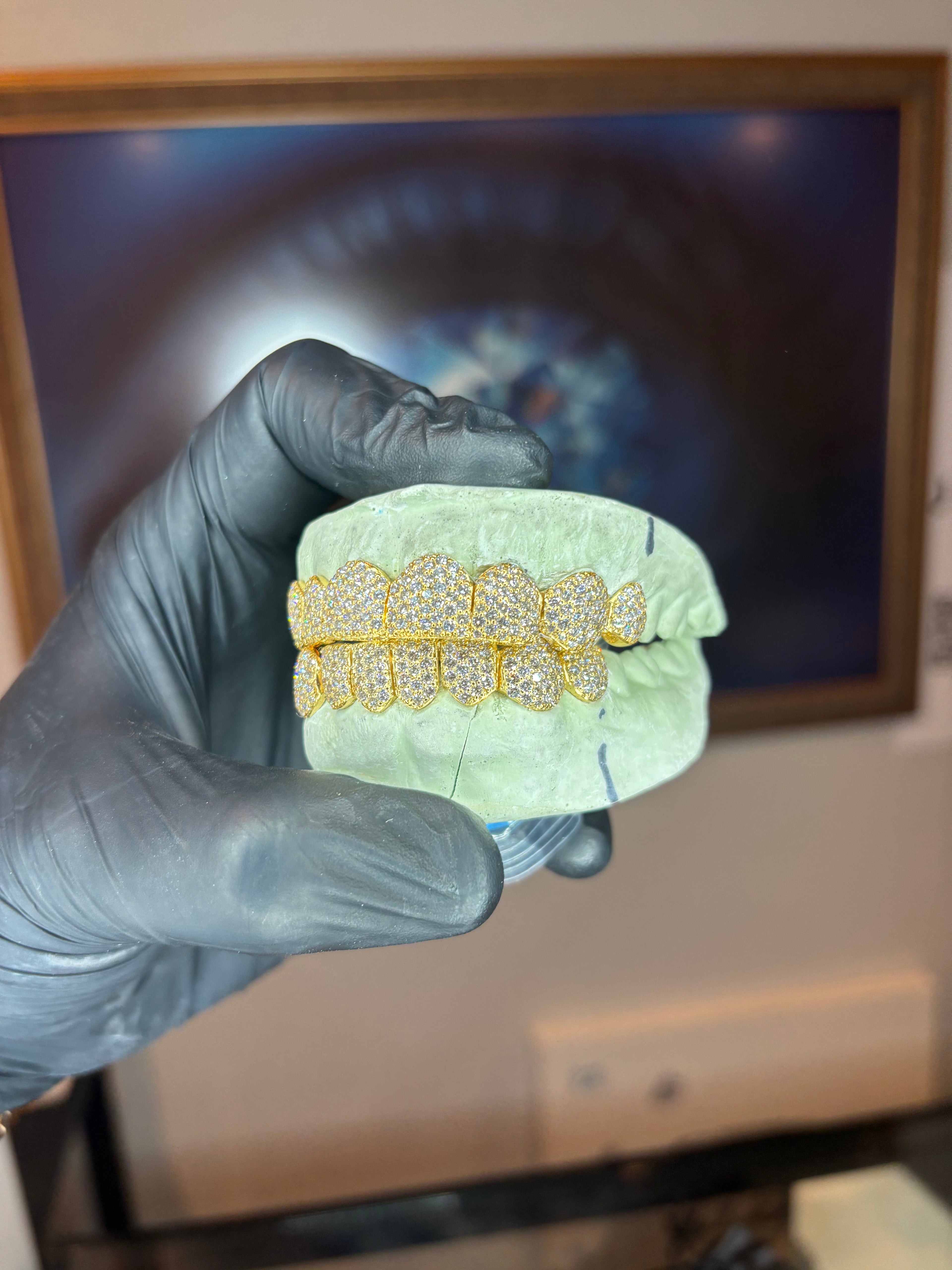 10K GOLD LAB GROWN DIAMOND GRILLZ