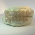 10K GOLD LAB GROWN DIAMOND GRILLZ