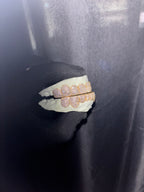 10K GOLD LAB GROWN DIAMOND GRILLZ