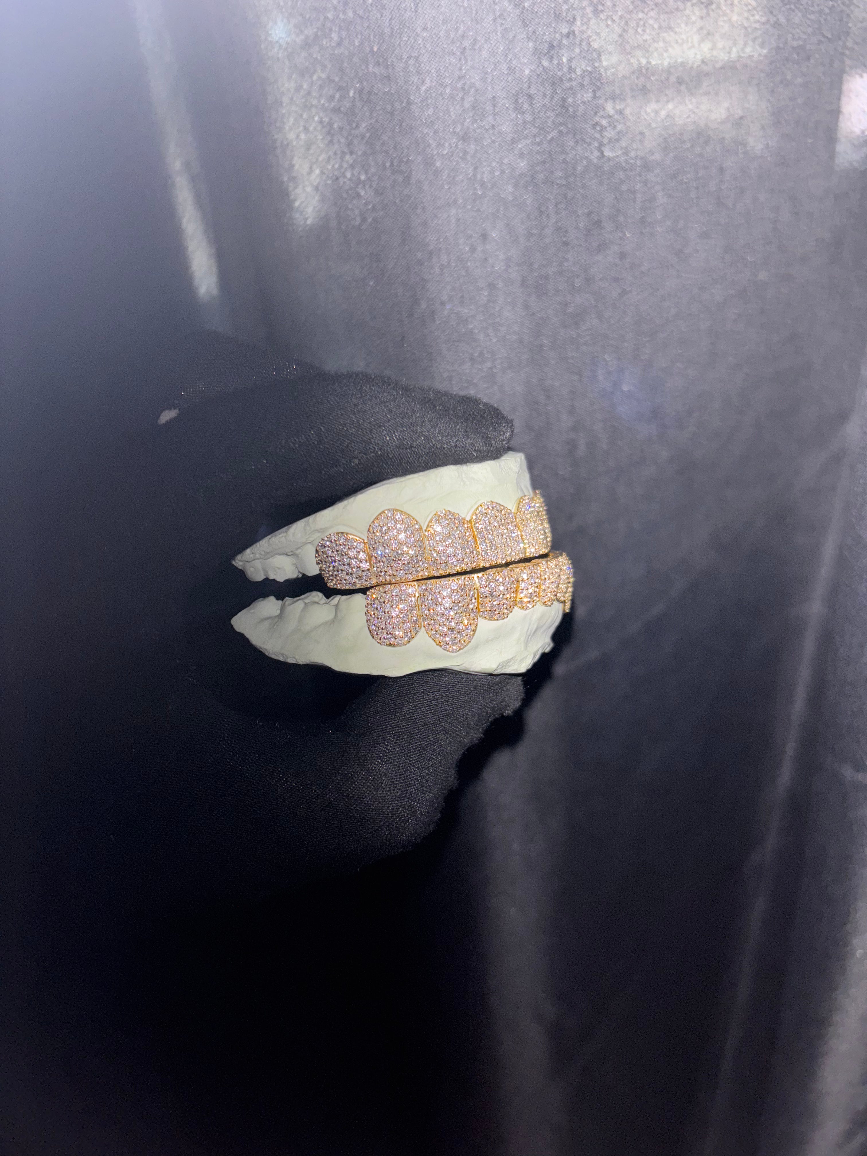 10K GOLD LAB GROWN DIAMOND GRILLZ