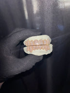 10K GOLD LAB GROWN DIAMOND GRILLZ