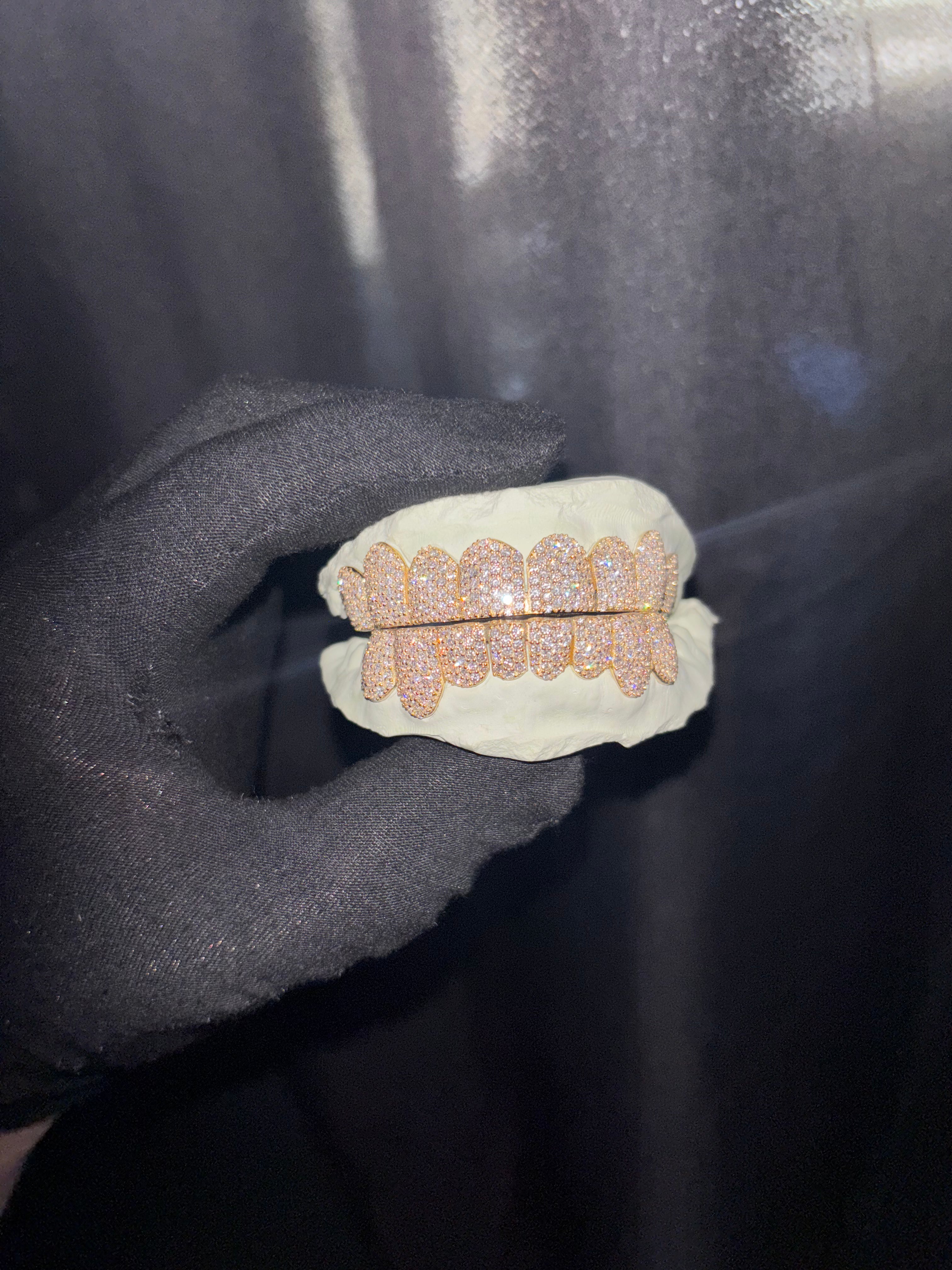 10K GOLD LAB GROWN DIAMOND GRILLZ